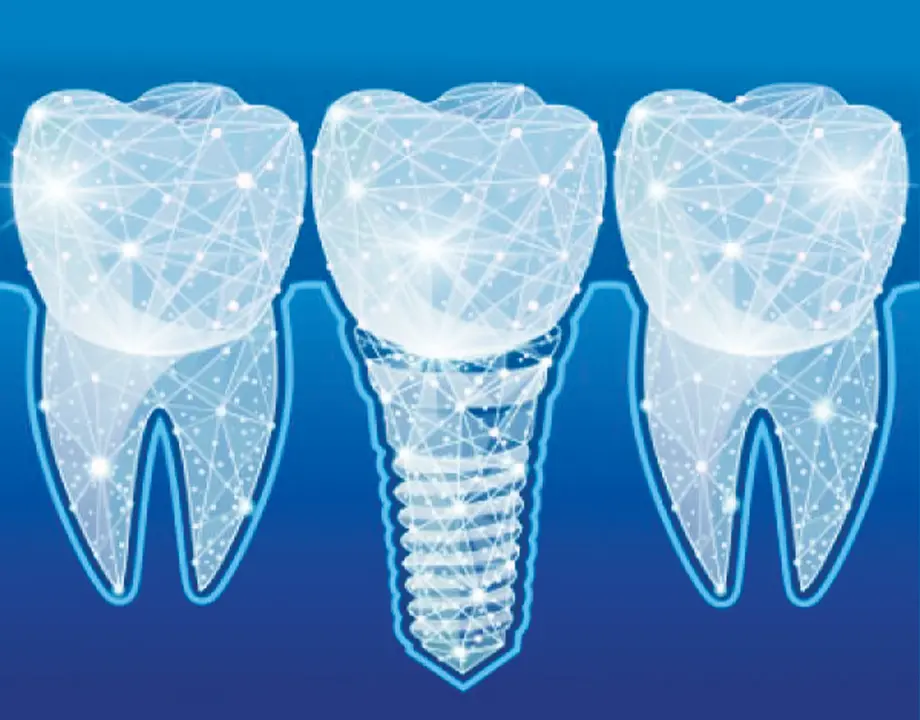 The Riley Dental Studio - Dental Implants, Staffordshire