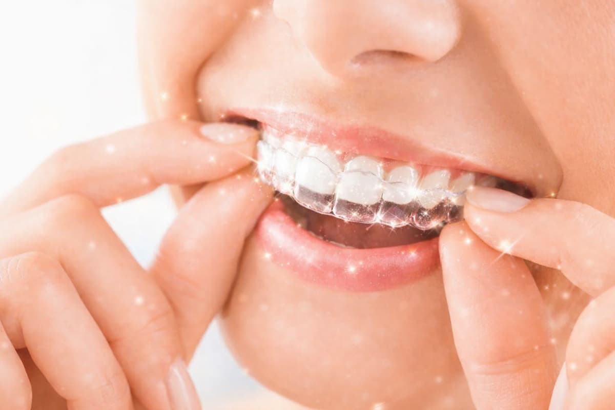 Start the New Year with a Confident Smile